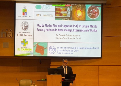 odonto-fibrina-teaser_4d5751d31805f2e66feef36613e94b55