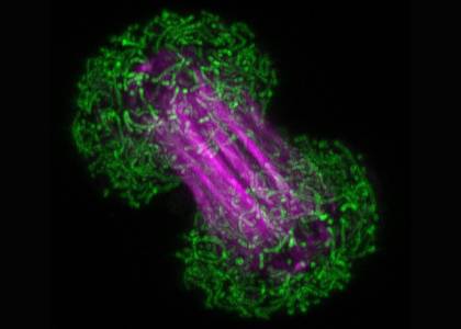 estudio-celulas-teaser